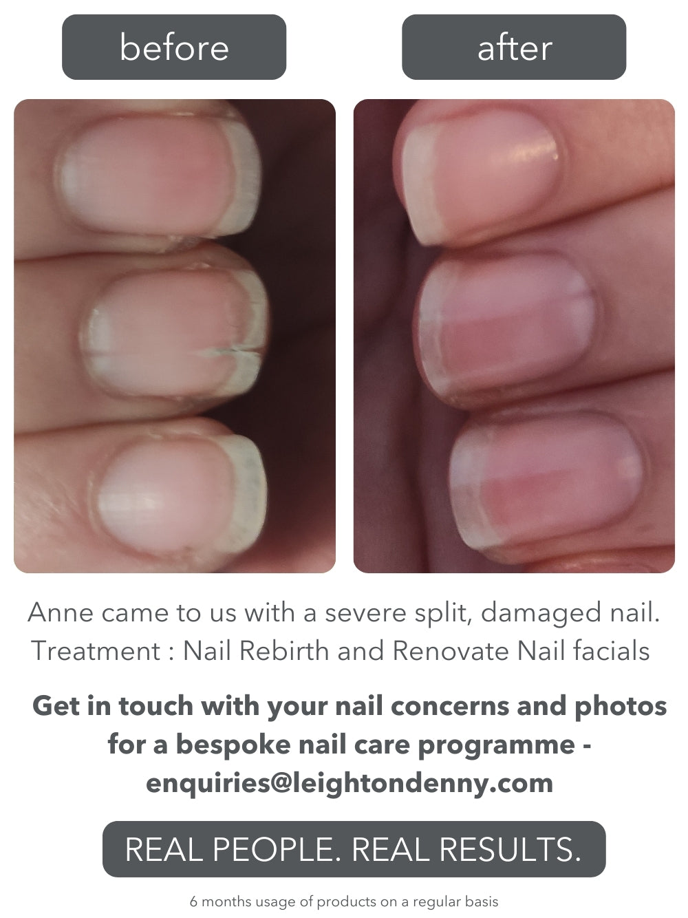 Renovate Nail Facial Kit SPECIAL VALUE