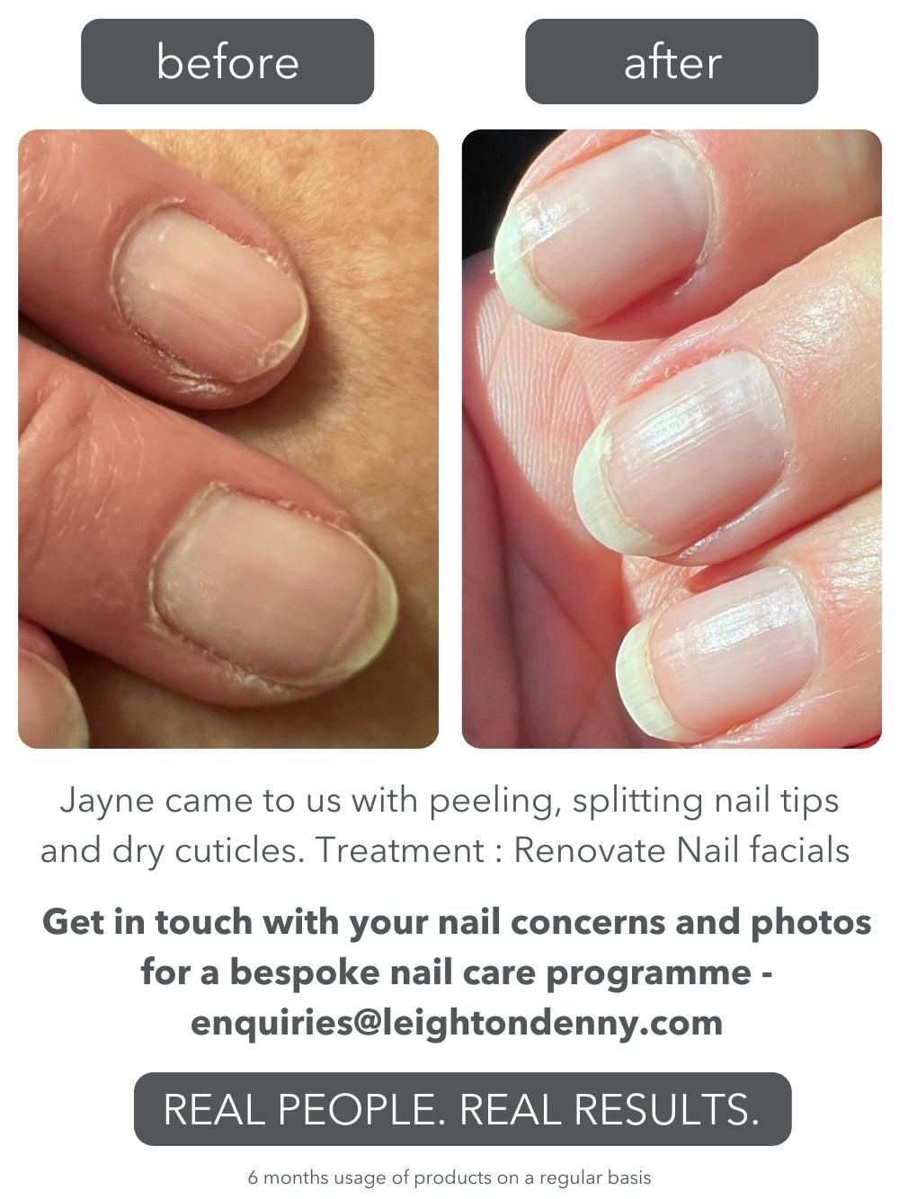 Renovate Nail Facial Kit SPECIAL VALUE